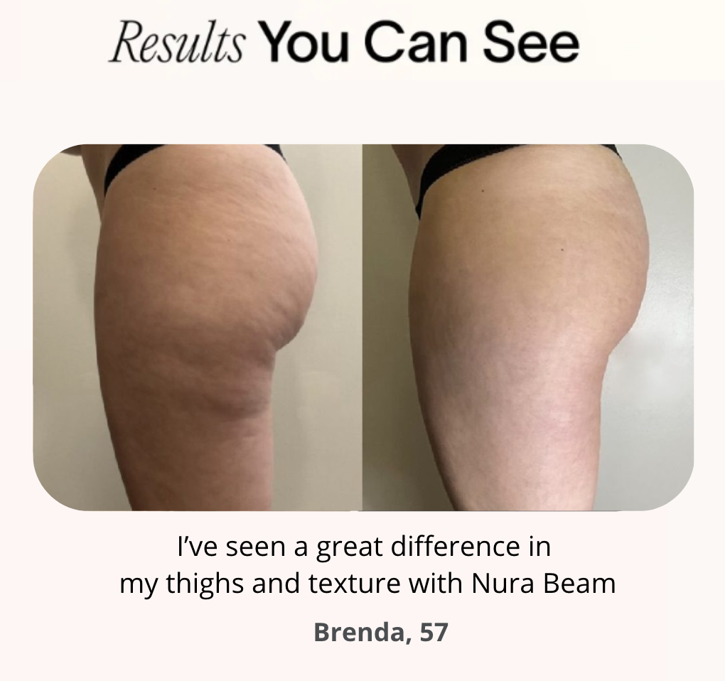 Premium Slimming Thigh Wrap: Sculpt and Tone for Enhanced Body Confidence