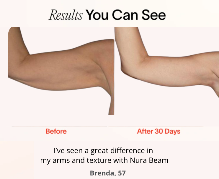 NuraBeam Smart Light Therapy Device for Enhanced Mood and Better Sleep